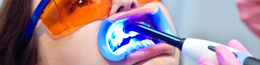 clareamento com laser