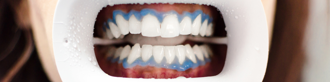 clareamento consultorio