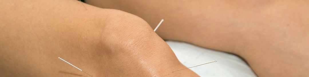 acunputura