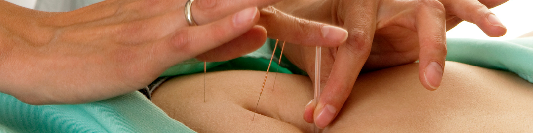 acunputura