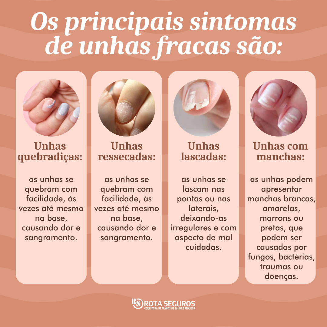 unhas fracas