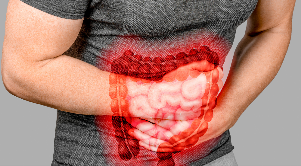 Síndrome do Cólon Irritável