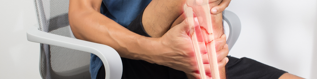 Chá de amora Chá de amora