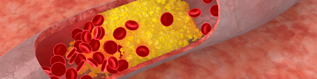 Chá de amora Chá de amora
