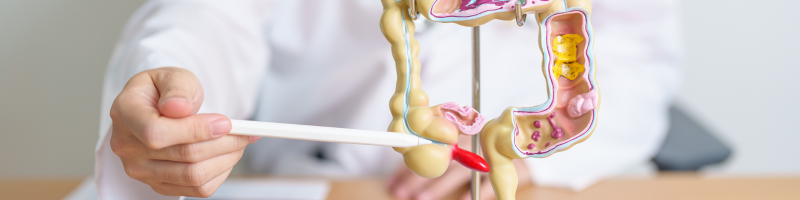 Câncer colorretal, quais são os fatores de risco