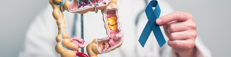 Diagnóstico e tratamento para o câncer colorretal