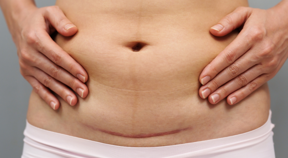 Alimentos Cicatrizantes: Conheça algumas dessas potências