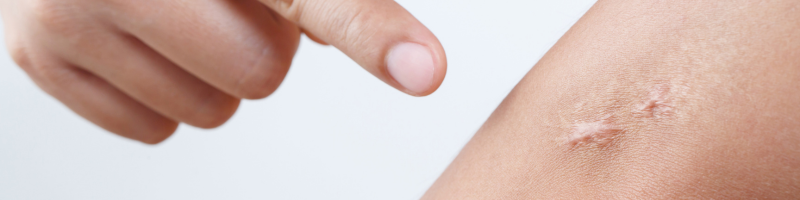 Aposte nessas potencias cicatrizantes!