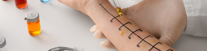 Como é feito o teste de alergia