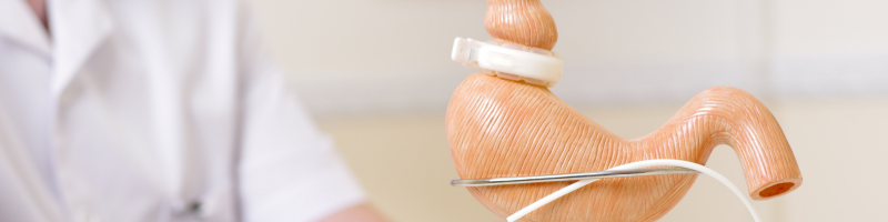 O que é cirurgia bariátrica