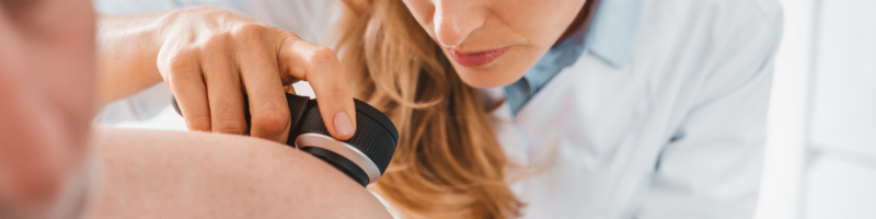 O que é o carcinoma basocelular?