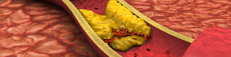Colesterol: O que muda na prática?