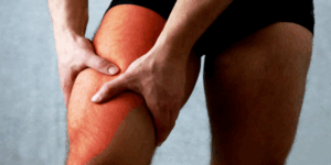 Lesão muscular na coxa: como tratar e prevenir