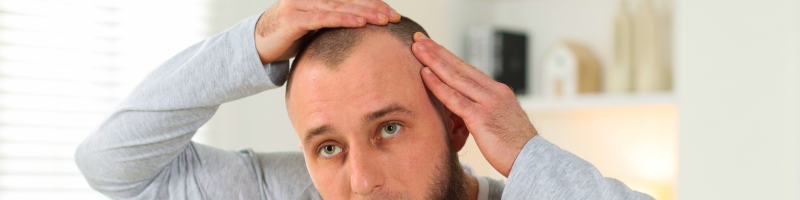 Calvície e o estresse físico e emocional