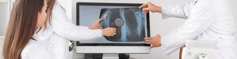 Prevenção contra a tuberculose