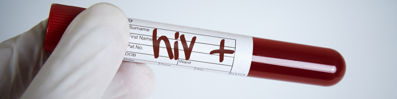 HIV e AIDS: qual é a diferença? HIV e AIDS: qual é a diferença?