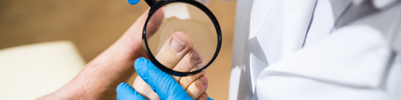 Quando procurar um podólogo?