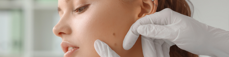 Prevenção também é cuidado com a saúde