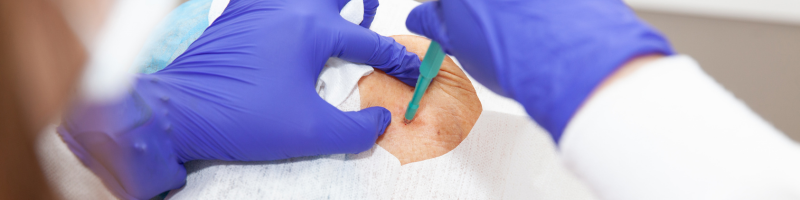 Ele pode estourar sozinho Ele pode estourar sozinho