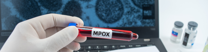 O que é Mpox O que é Mpox