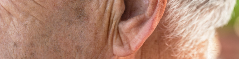 O que é o Sinal de Frank O que é o Sinal de Frank