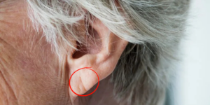 Sinal de Frank e a saúde cardiovascular entenda mais!