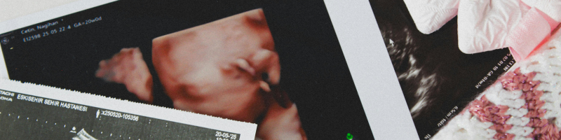 Por que os exames na gravidez são tão importantes