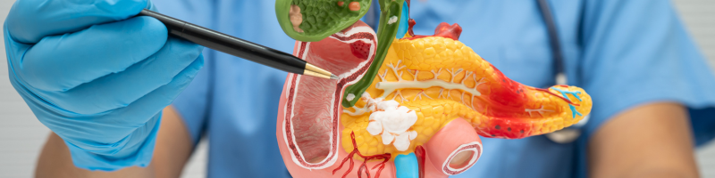 Existe relação entre Mounjaro e pancreatite