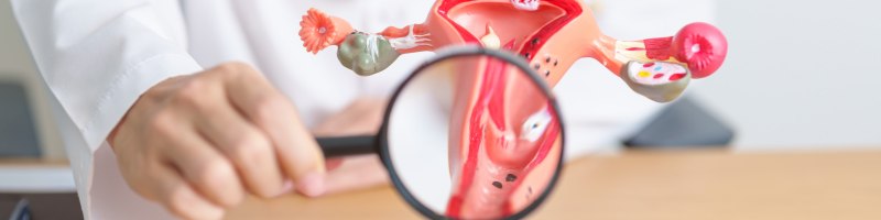O que é a endometriose